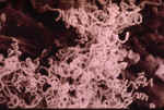 Photo of chains of Streptomyces